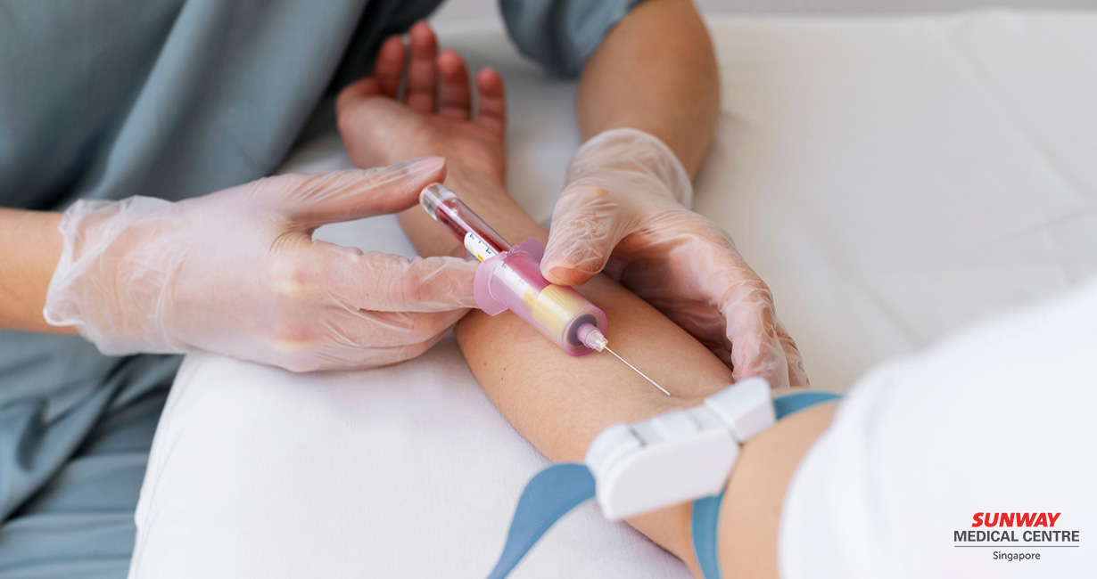 Blood Glucose-women health screening in Singapore